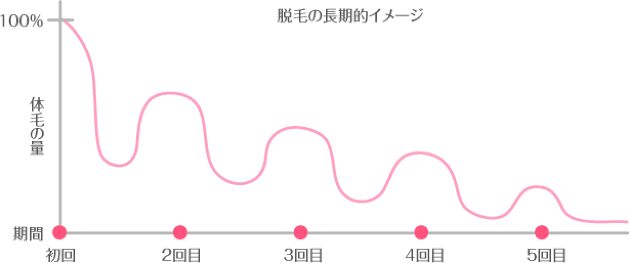脱毛の長期的イメージ